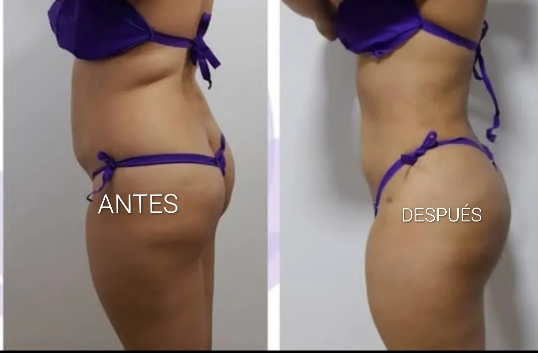 Lipoglutex