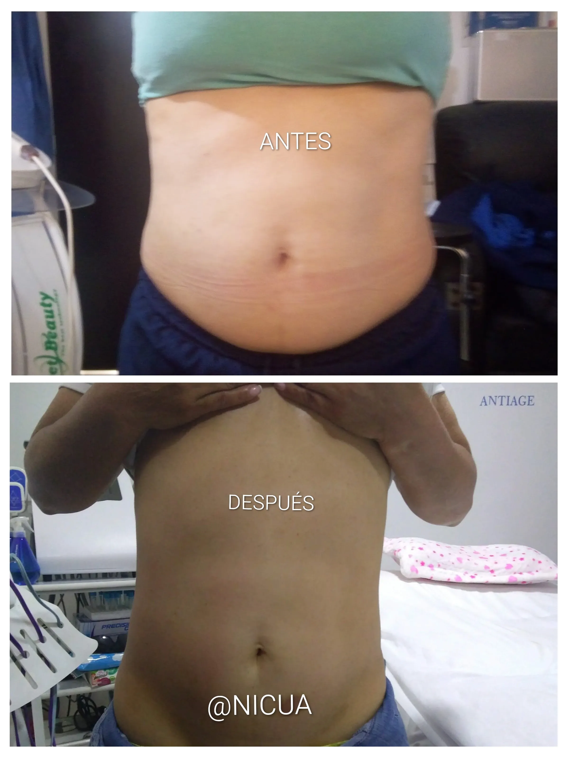 Liporedux