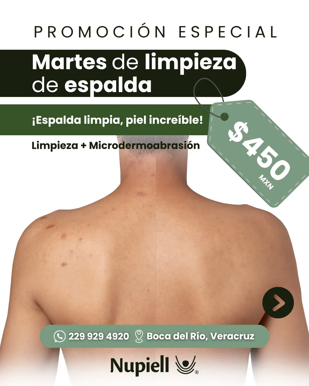 Limpieza de Espalda 80min - Imagen 1