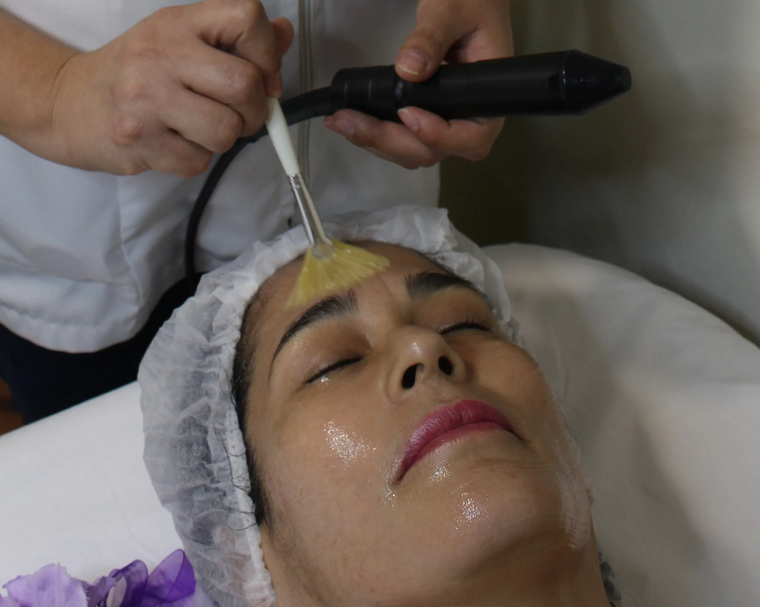 Radiofrecuencia Cosmética Orbicular - 70min.   - Imagen 2