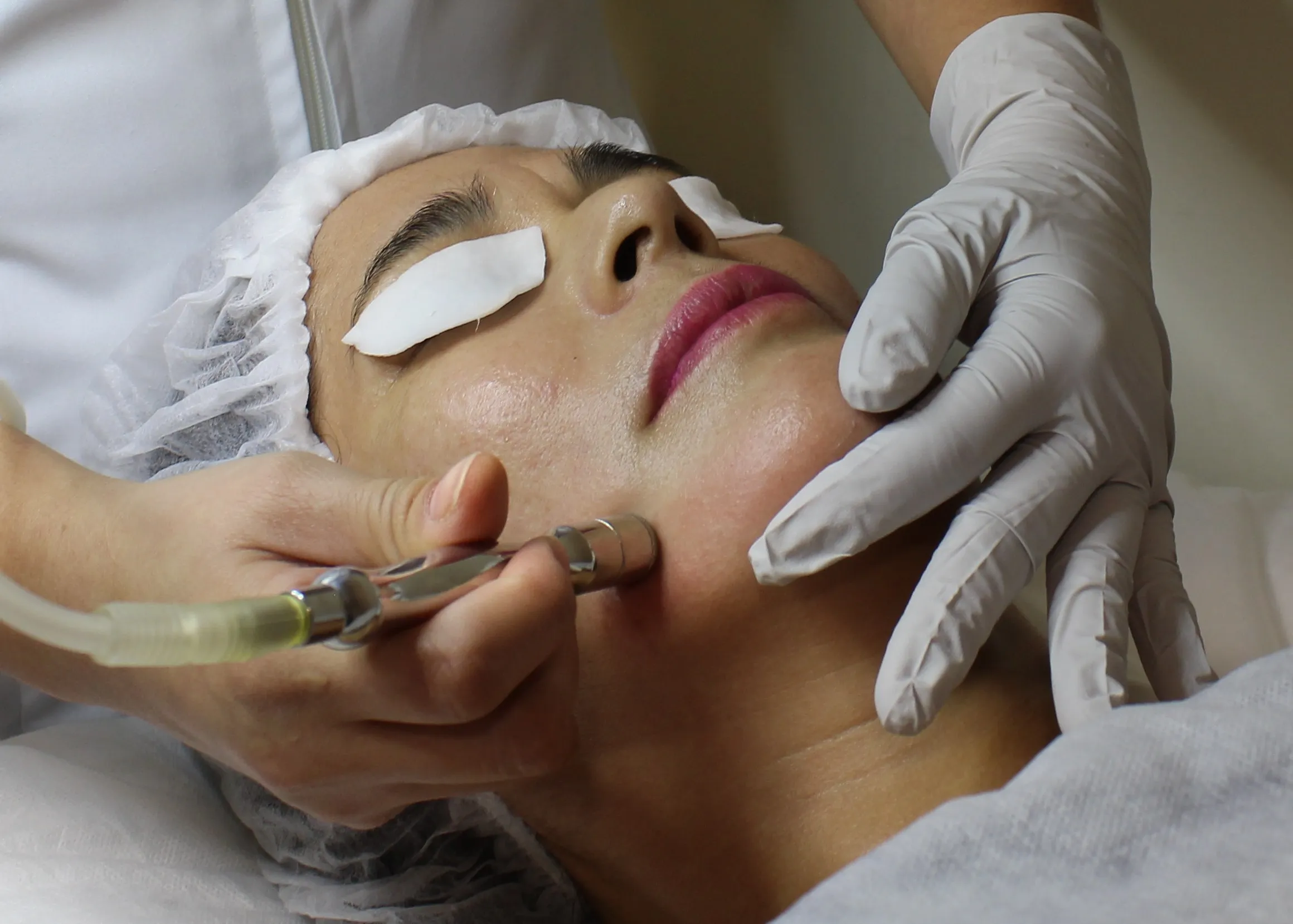 Microdermoabrasión Punta de Diamante 80min.[22521] - Imagen 1