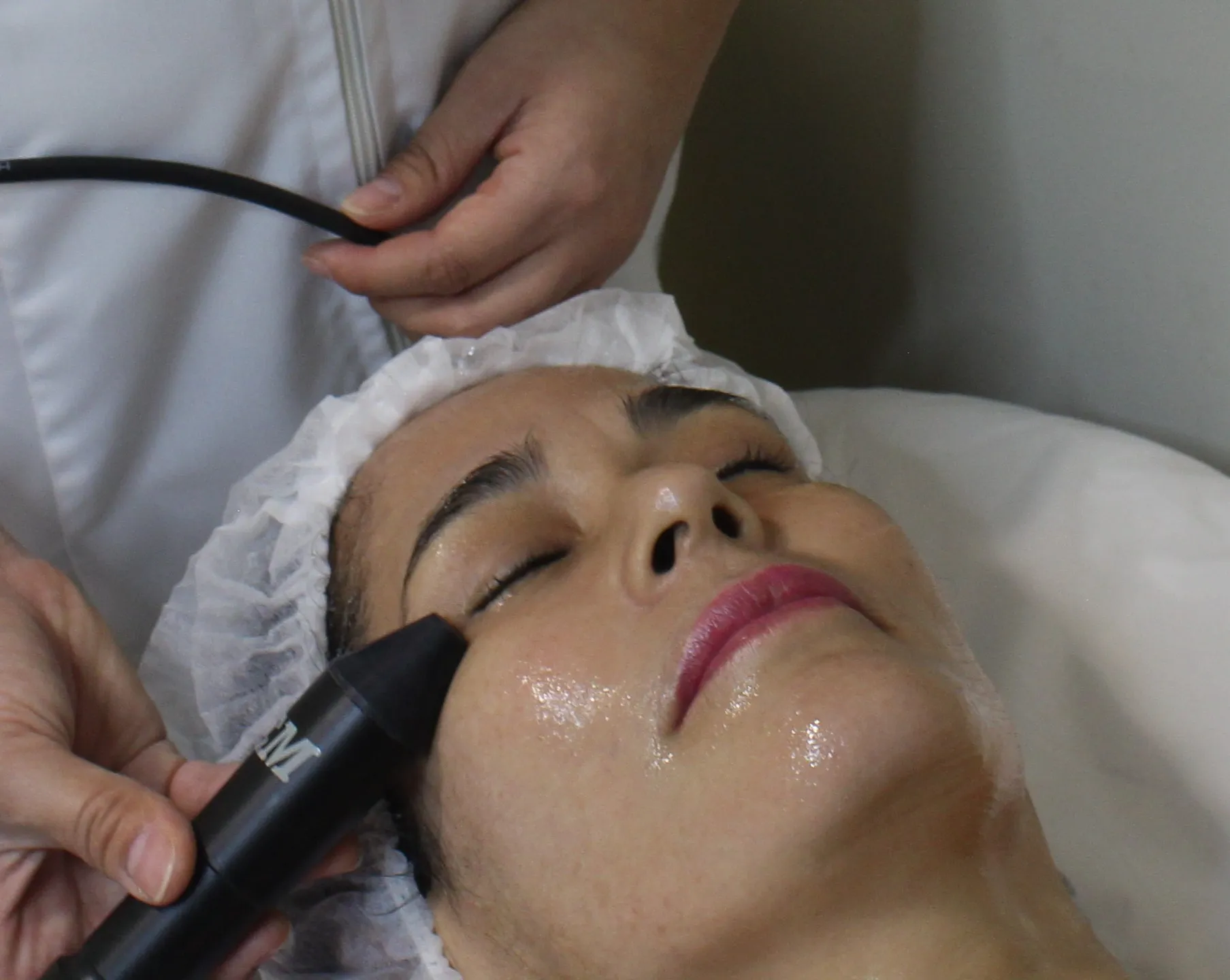 Radiofrecuencia Cosmética Orbicular - 70min.   - Imagen 1