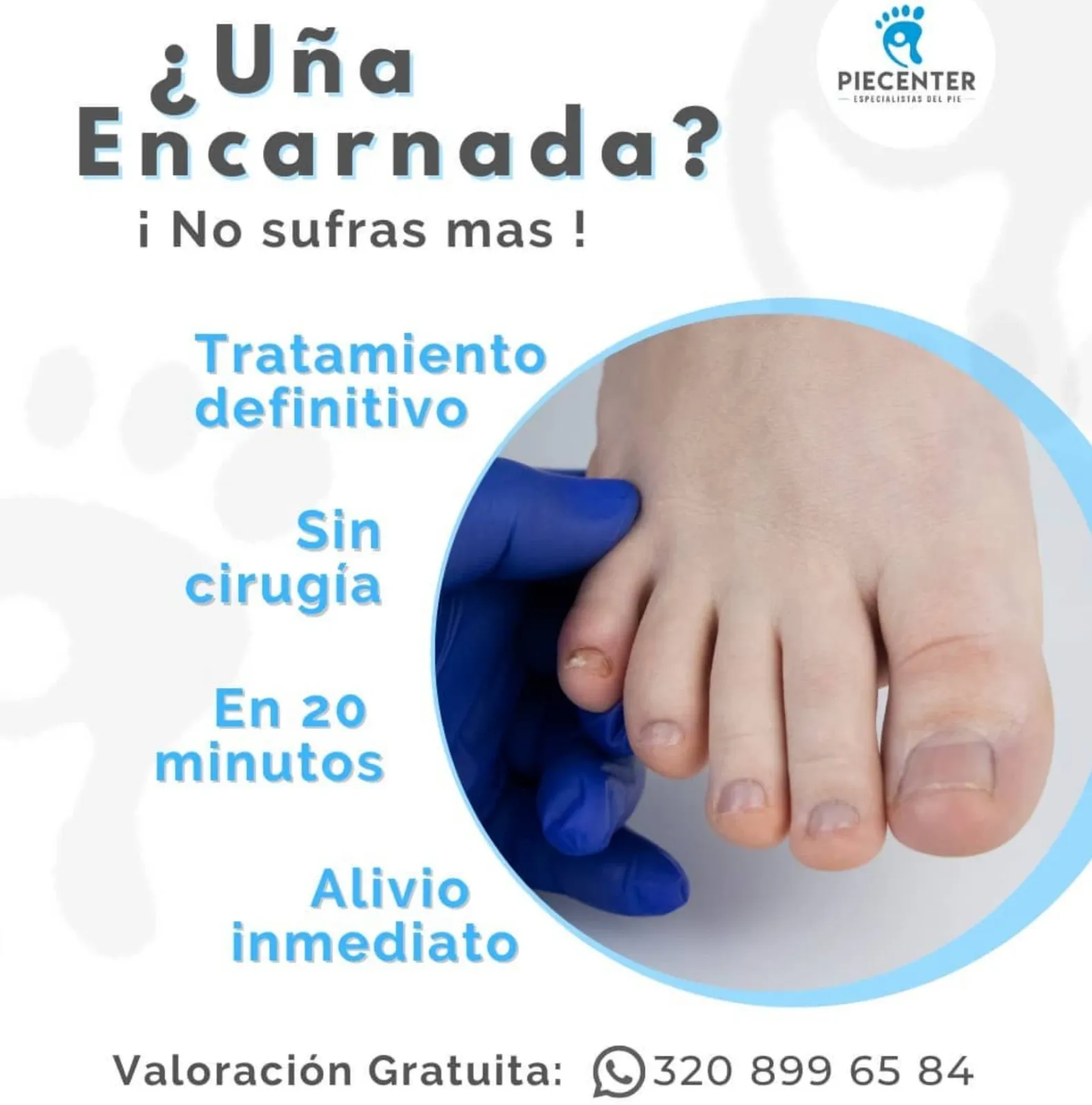 Uña Incrustada / Solución Definitiva