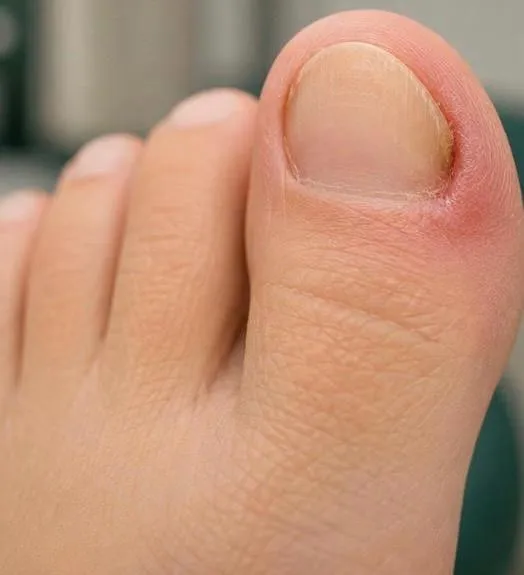 UÑEROS