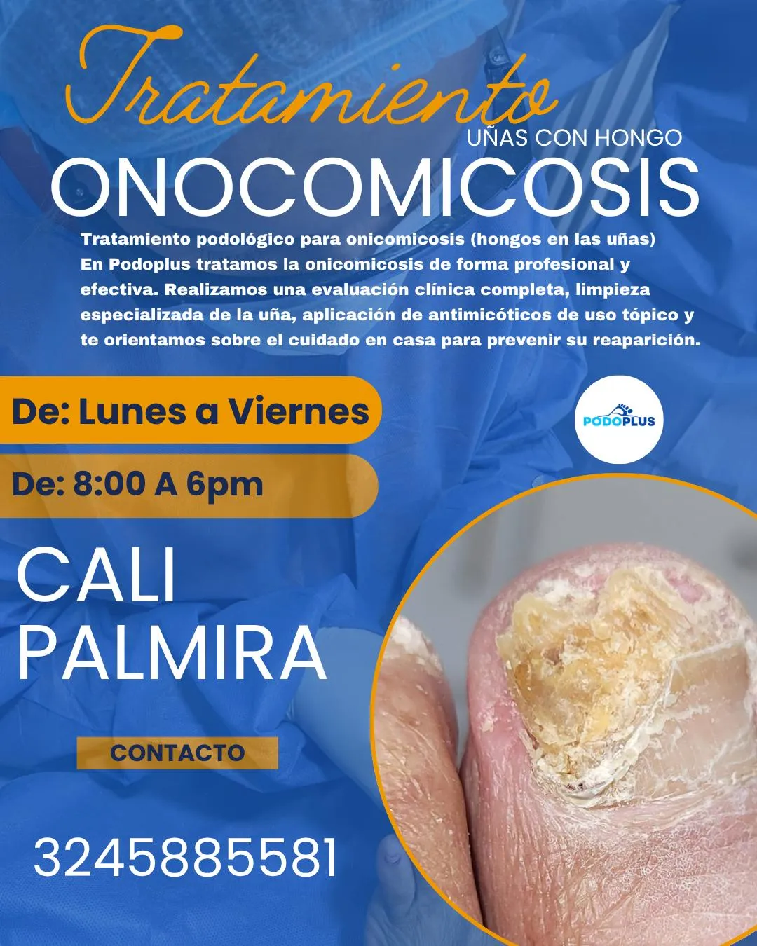 1217(cali) profilaxis HONGO EN UÑAS - Imagen 2