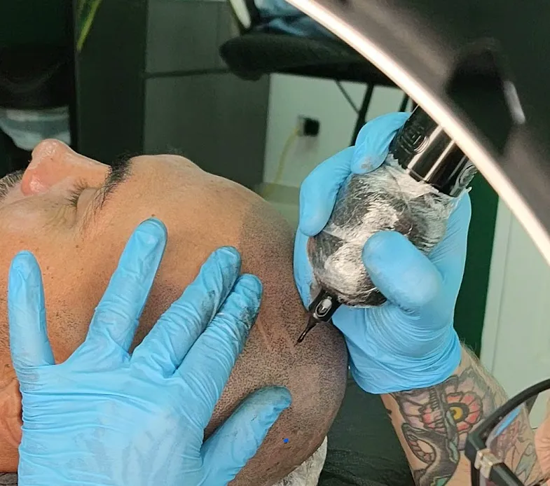 Micro Capilar (Sesión)