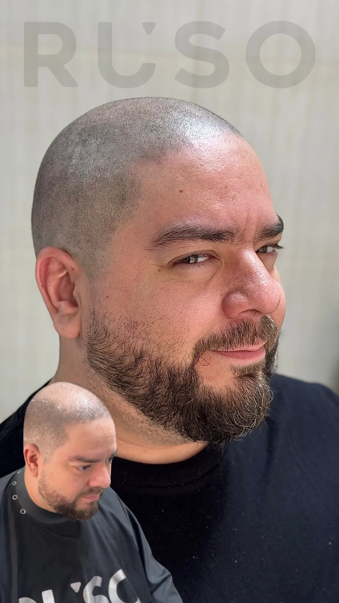 Micropigmentacion Capilar (Sesion)