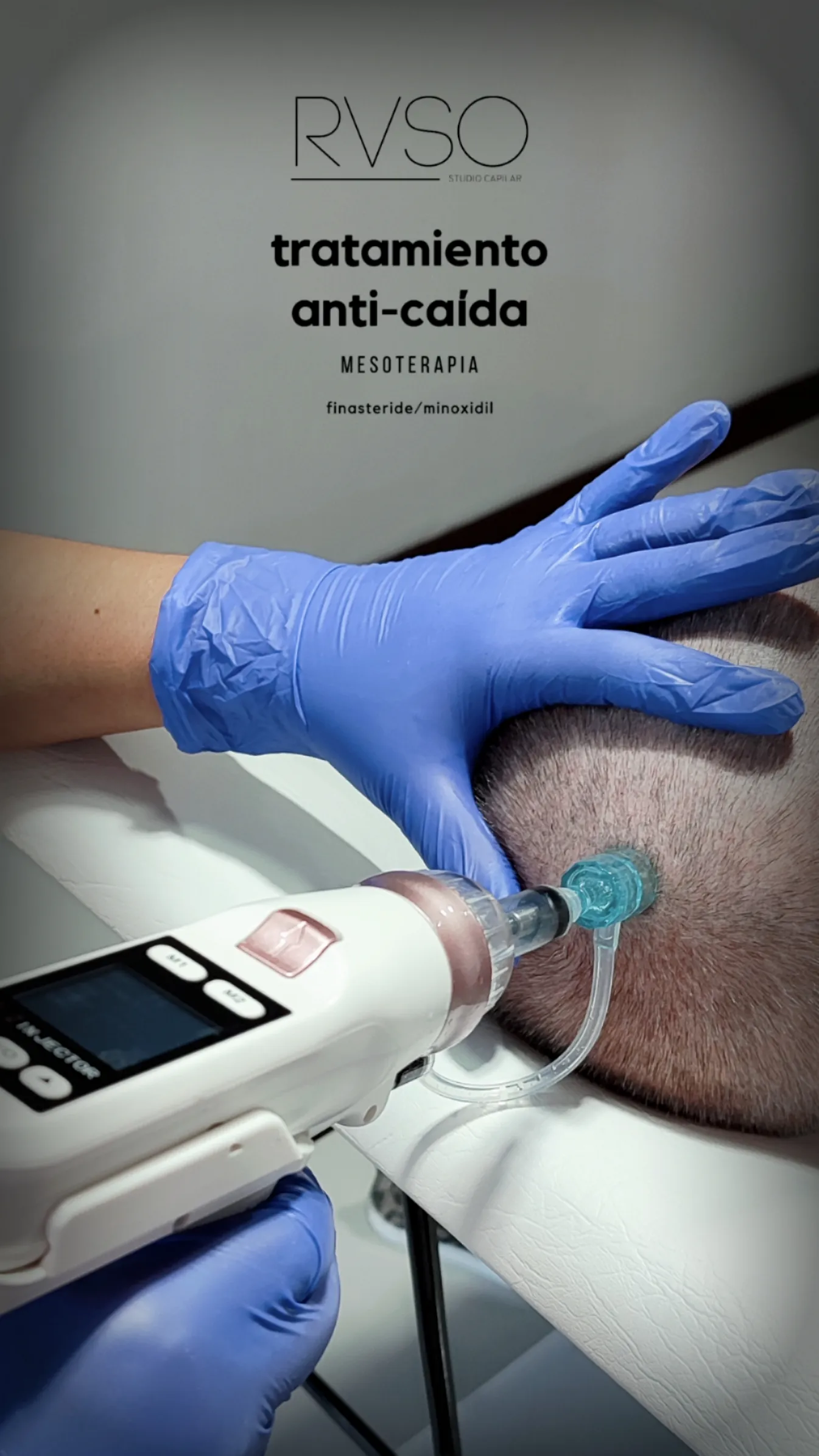 Sesion Mesoterapia