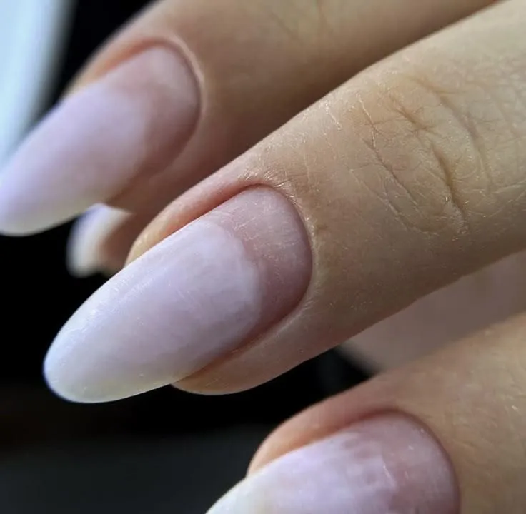 Retoque de Acrilico  - Imagen 1