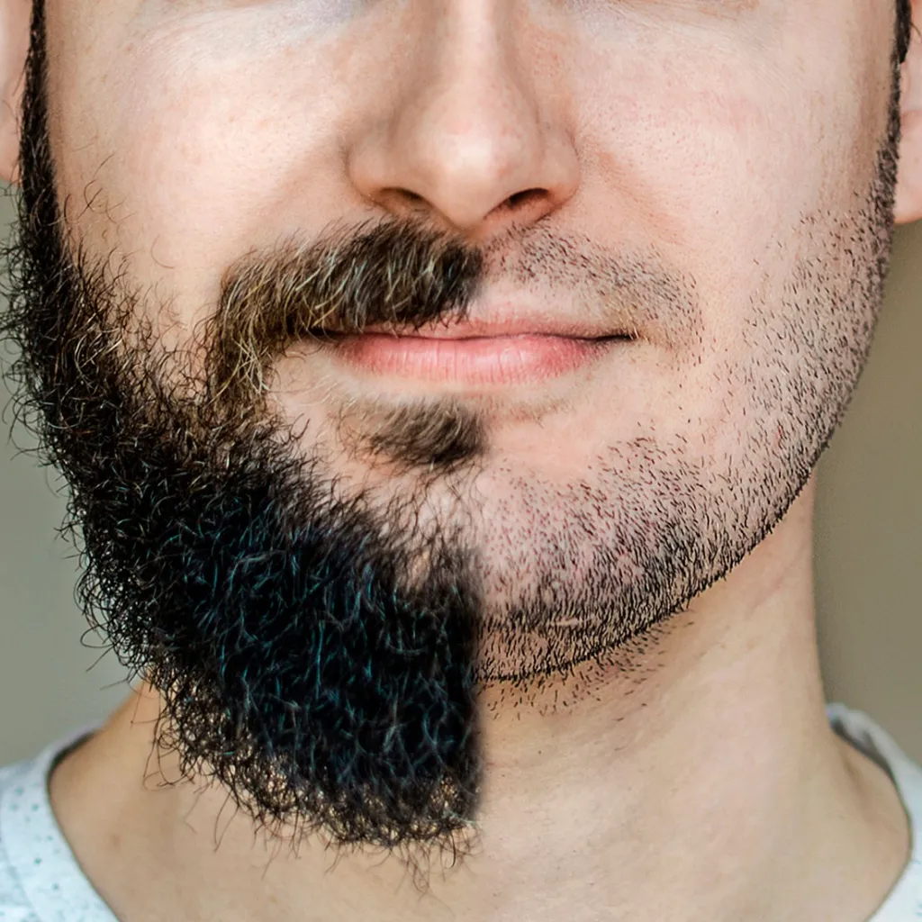BARBA
