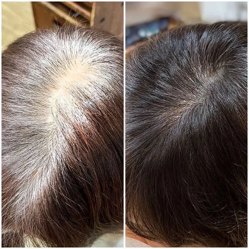 cubrimiento de camas