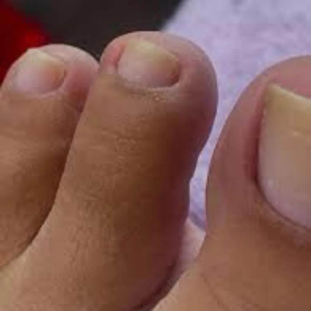 PEDICURE / SOLO LIMPIEZA