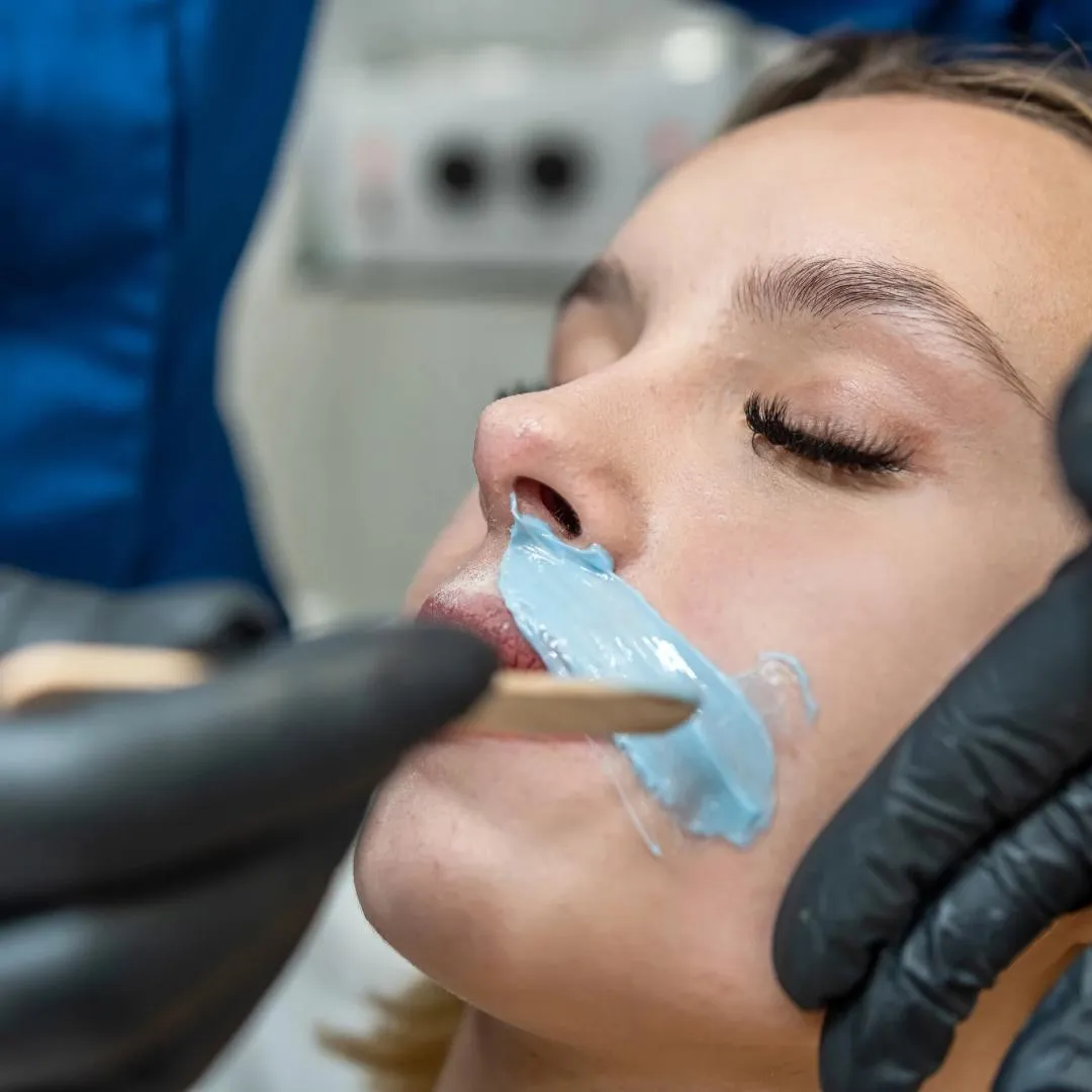 Depilación de bigote - Imagen 1