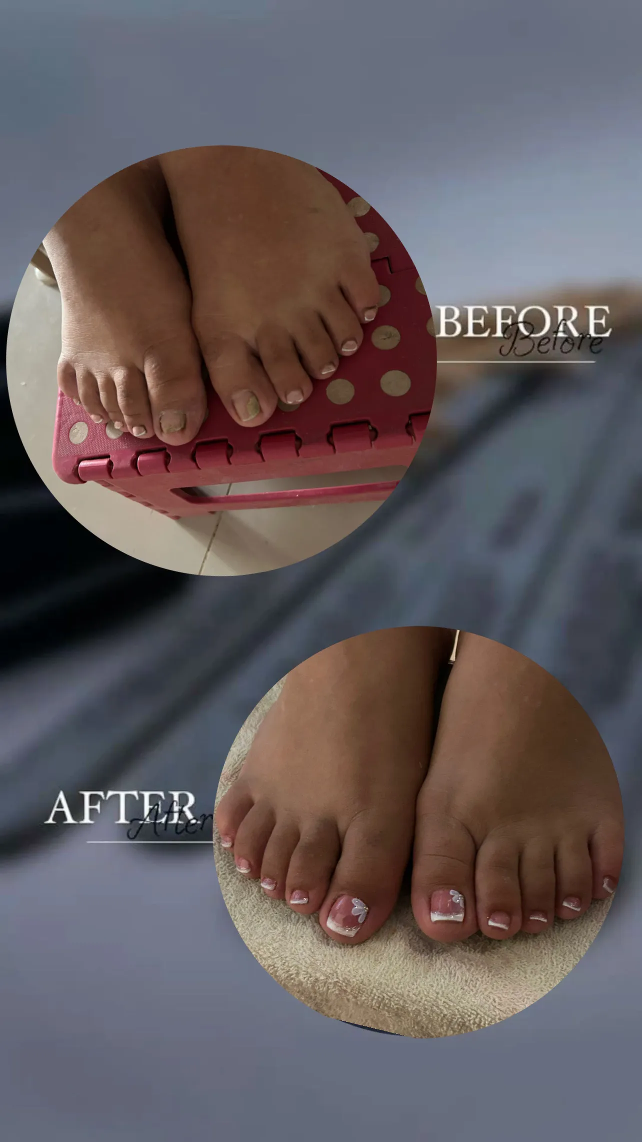 pedicura