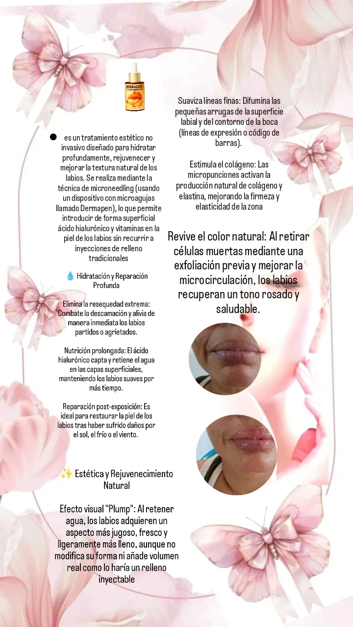 hidra lips /labios luminosos