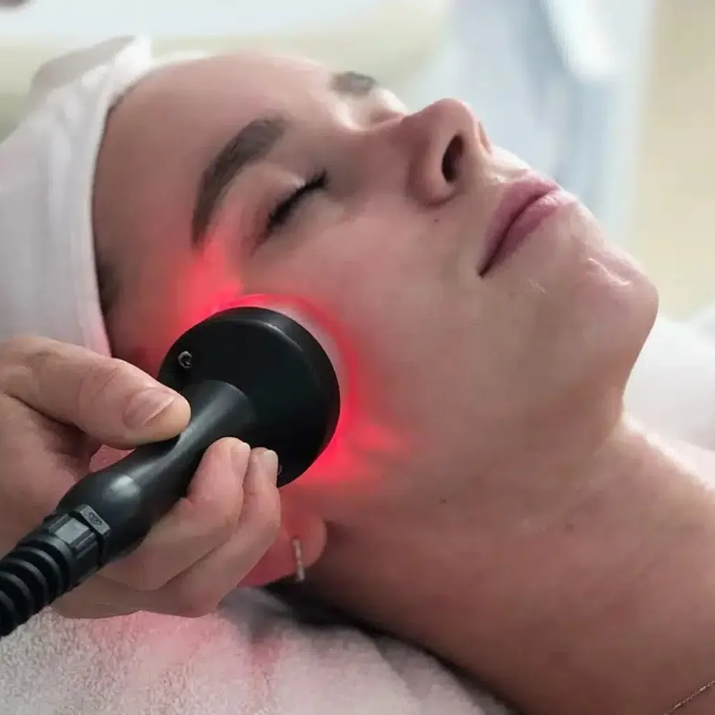 Radio Frecuencia Facial  - 2
