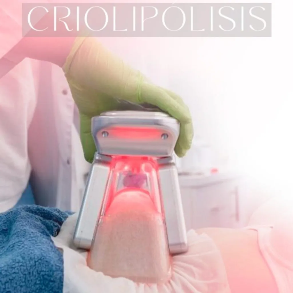 CRIOLIPOLISIS