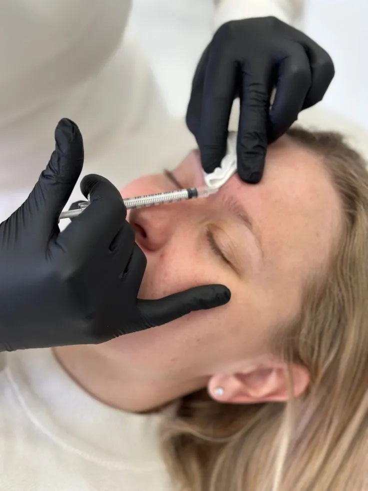 Party Botox 50 U - Imagen 1