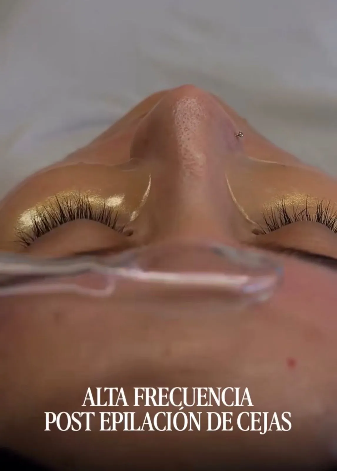 Regeneración y Recuperación de cejas - 3