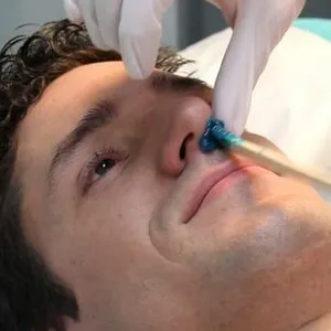 DEPILACION NASAL - 1