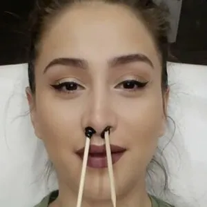 DEPILACION NASAL - 2