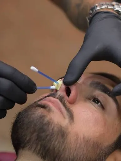 Depilación Nasal