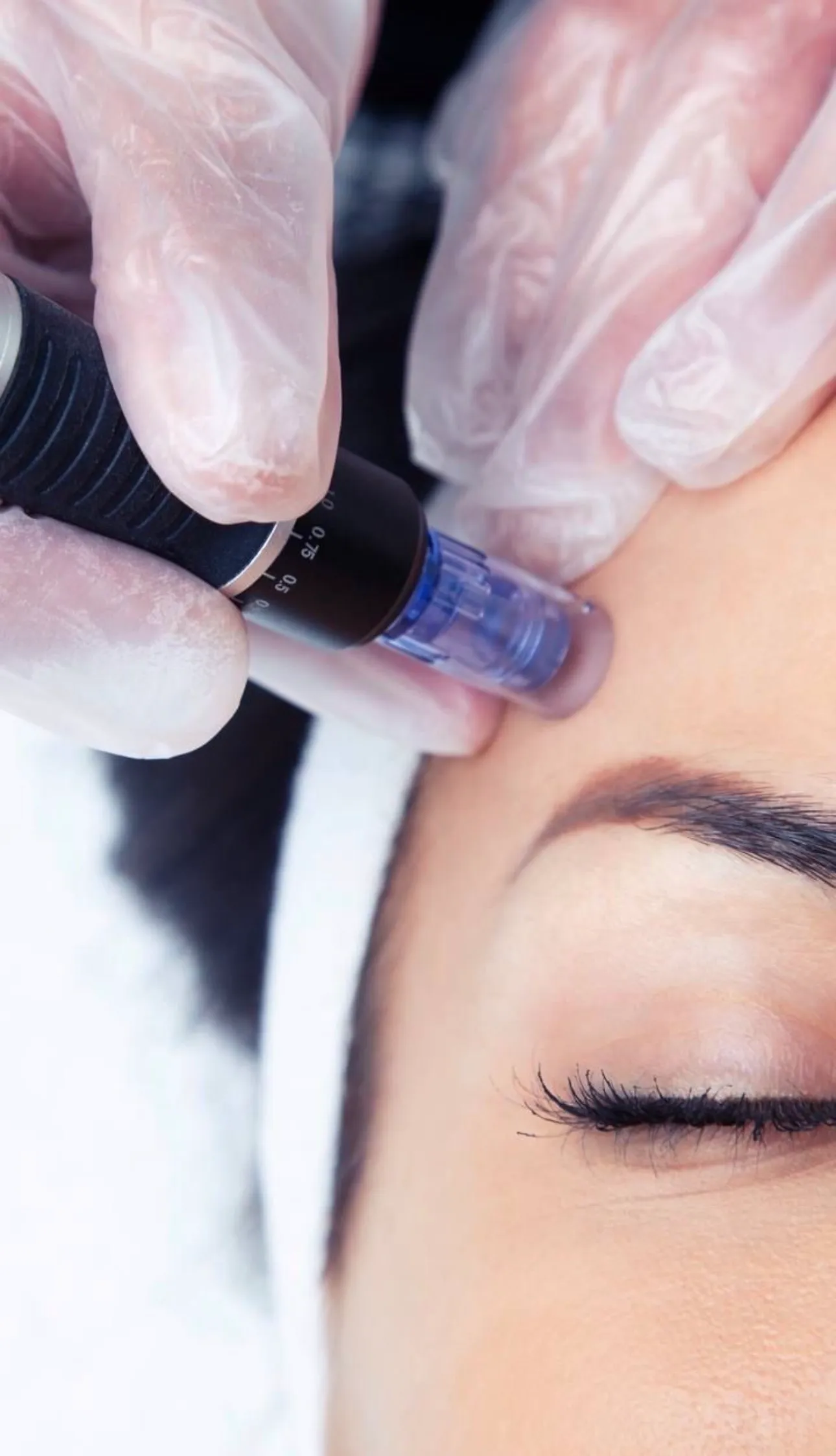 FACIAL DERMAPEN