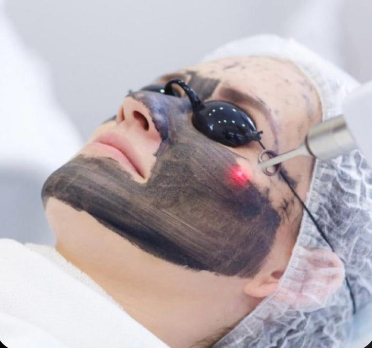 Limpieza Facial + Hollywood Peeling 2 sesiones