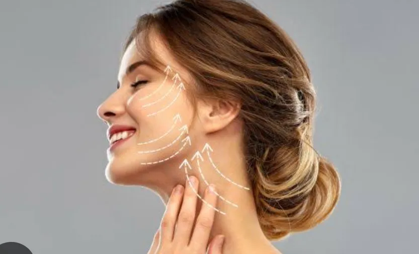 aplicación hilos de colágeno en rostro y cuello 