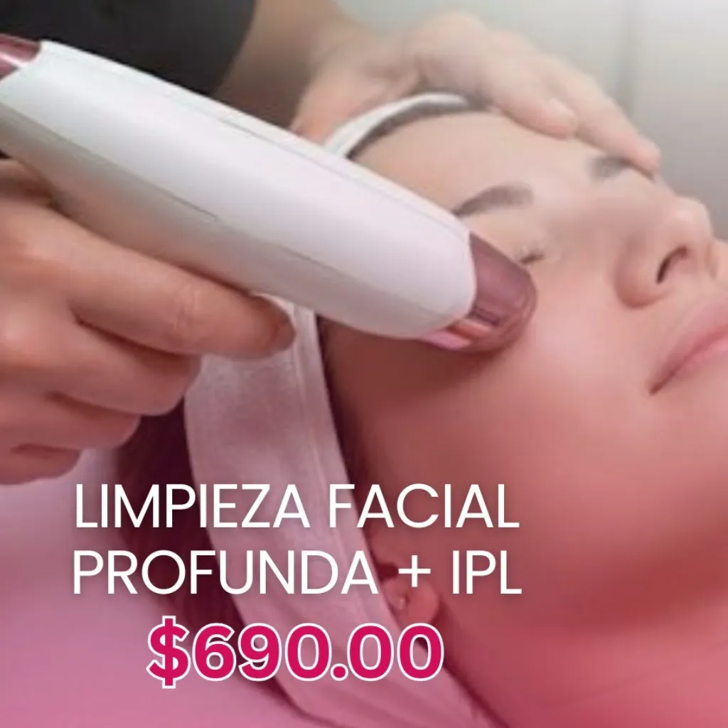 Rejuvenecimiento Facial con radio frecuencia e IPL 