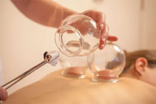 TF05-Ventosas - Imagen 1