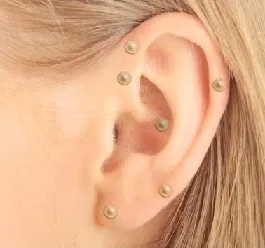 TF07-Auriculoterapia - Imagen 1