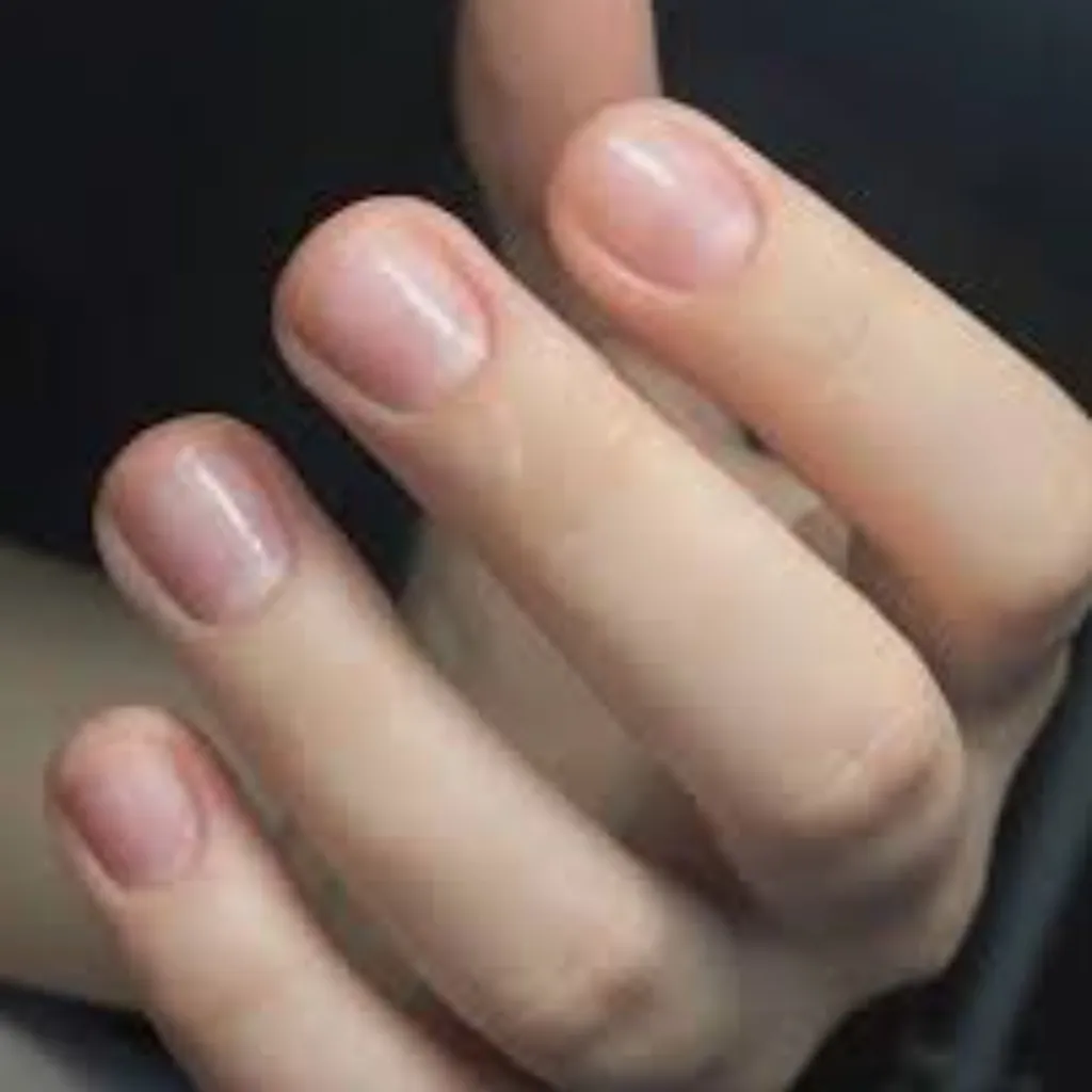Polinchado De Uñas