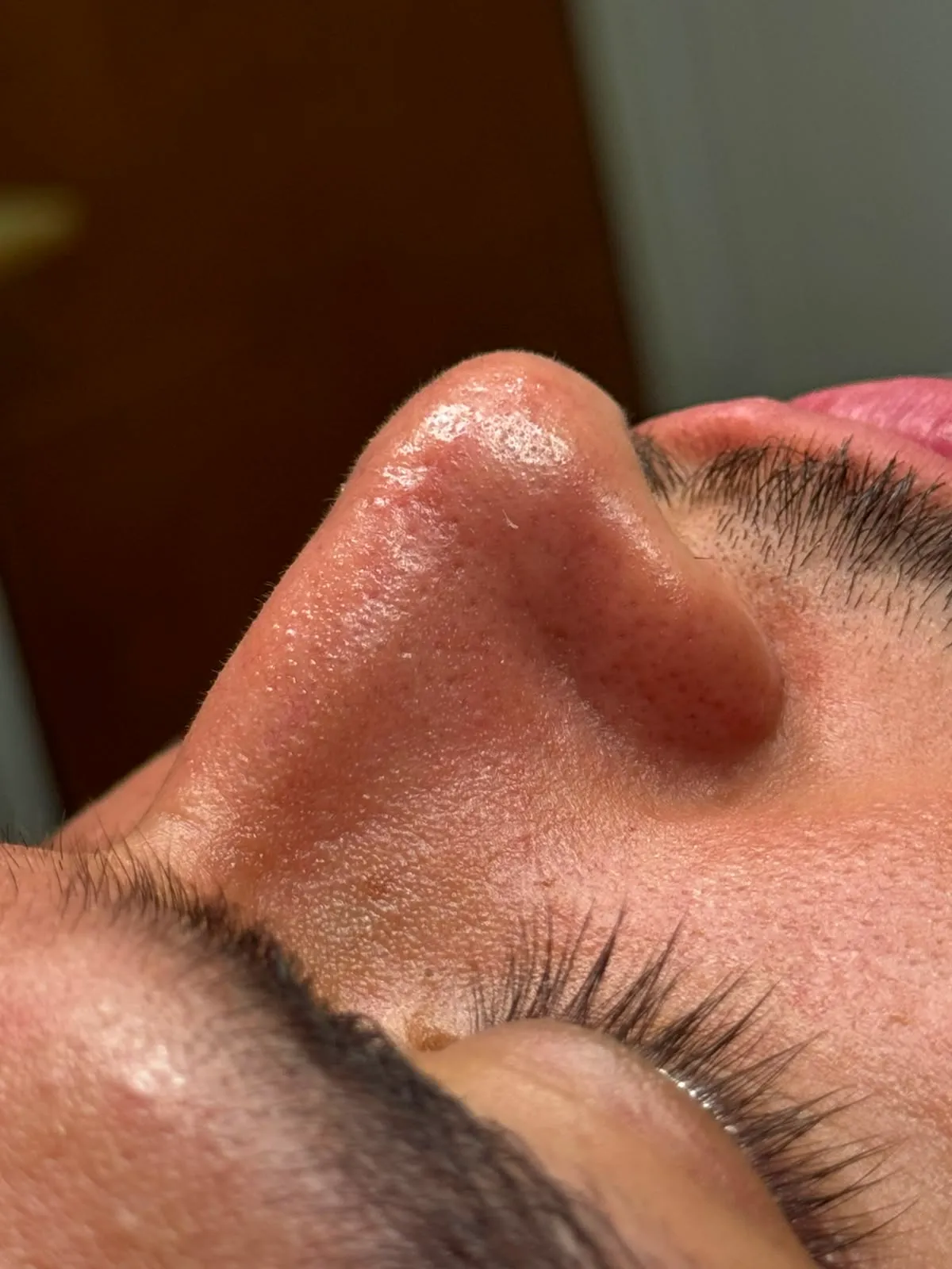 FACIAL DETOX - 3