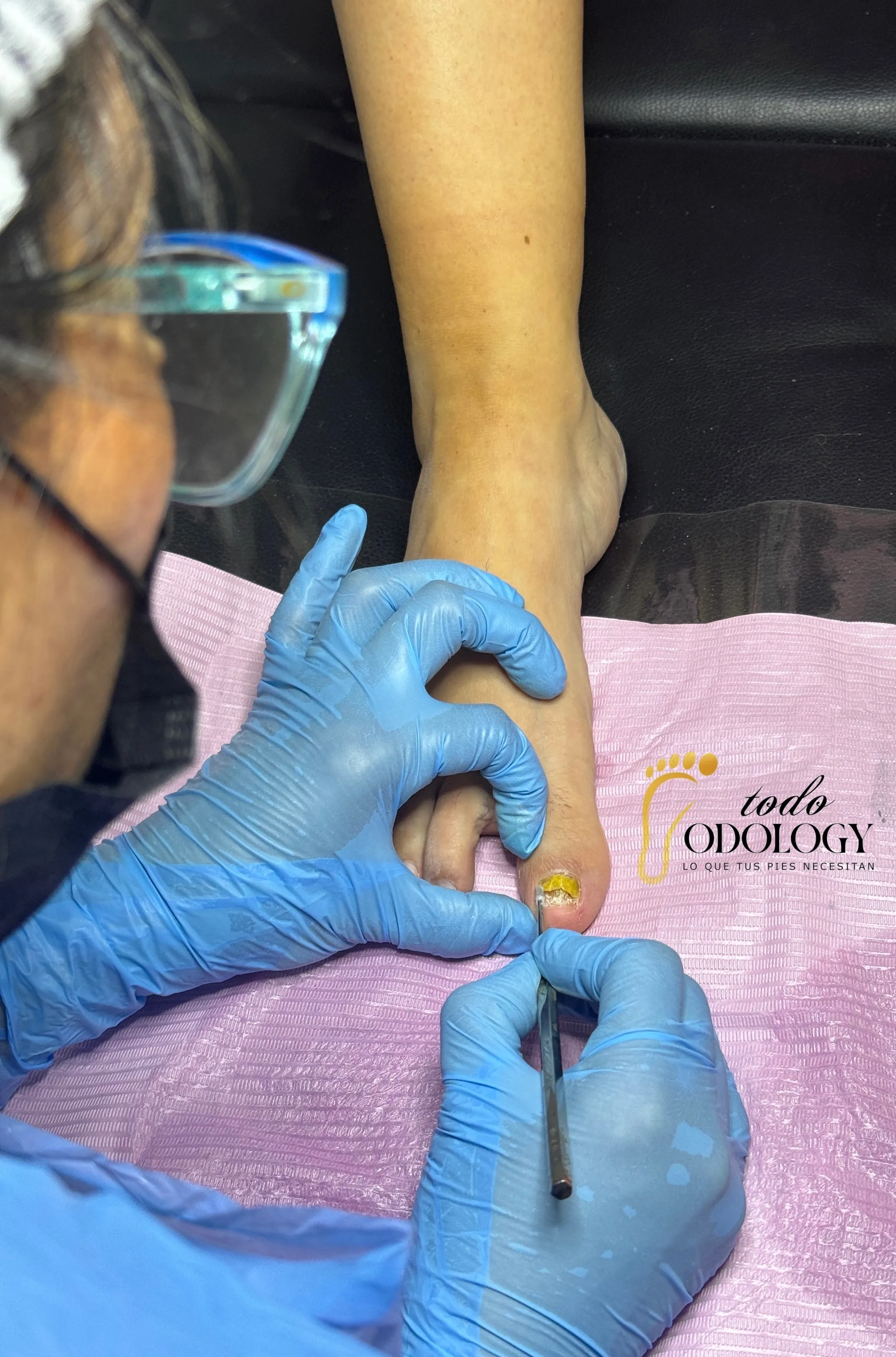 Medicación onicomicosis