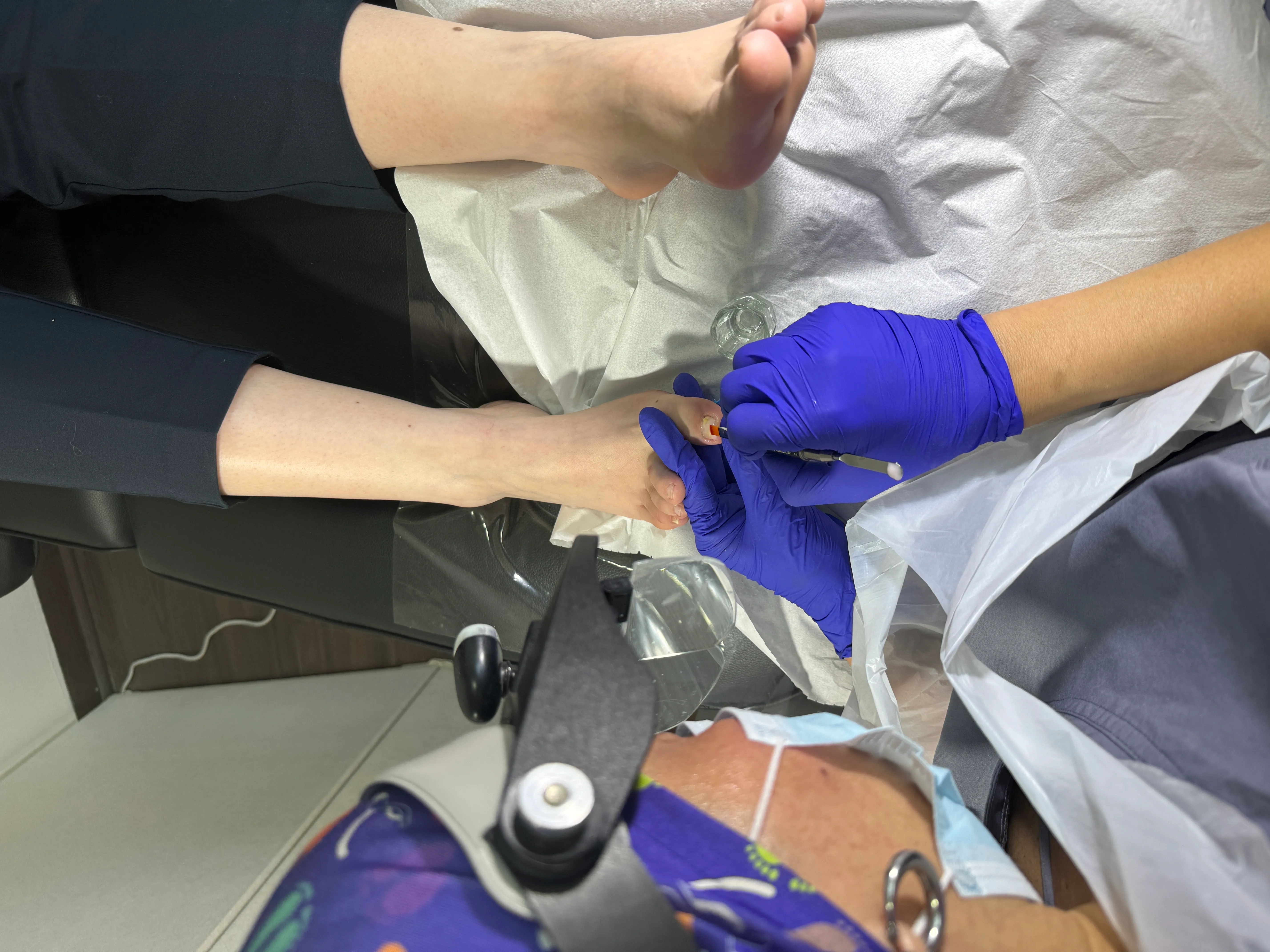 Reconstrucción en los 10 ortejos - Imagen 1