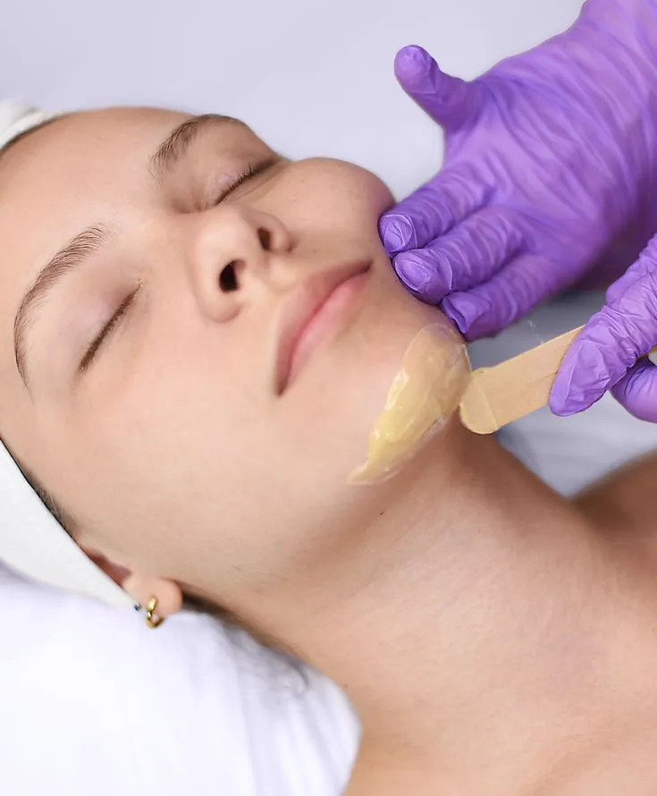 Epilación de Mentón