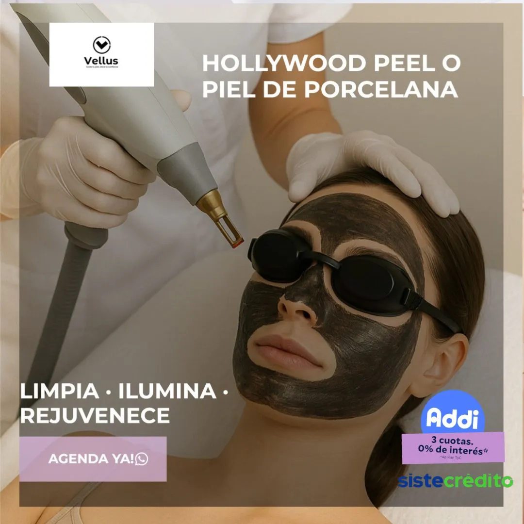 Hollywood peeling - Imagen 1