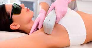 DEPILACION LASER AXILA - Imagen 1