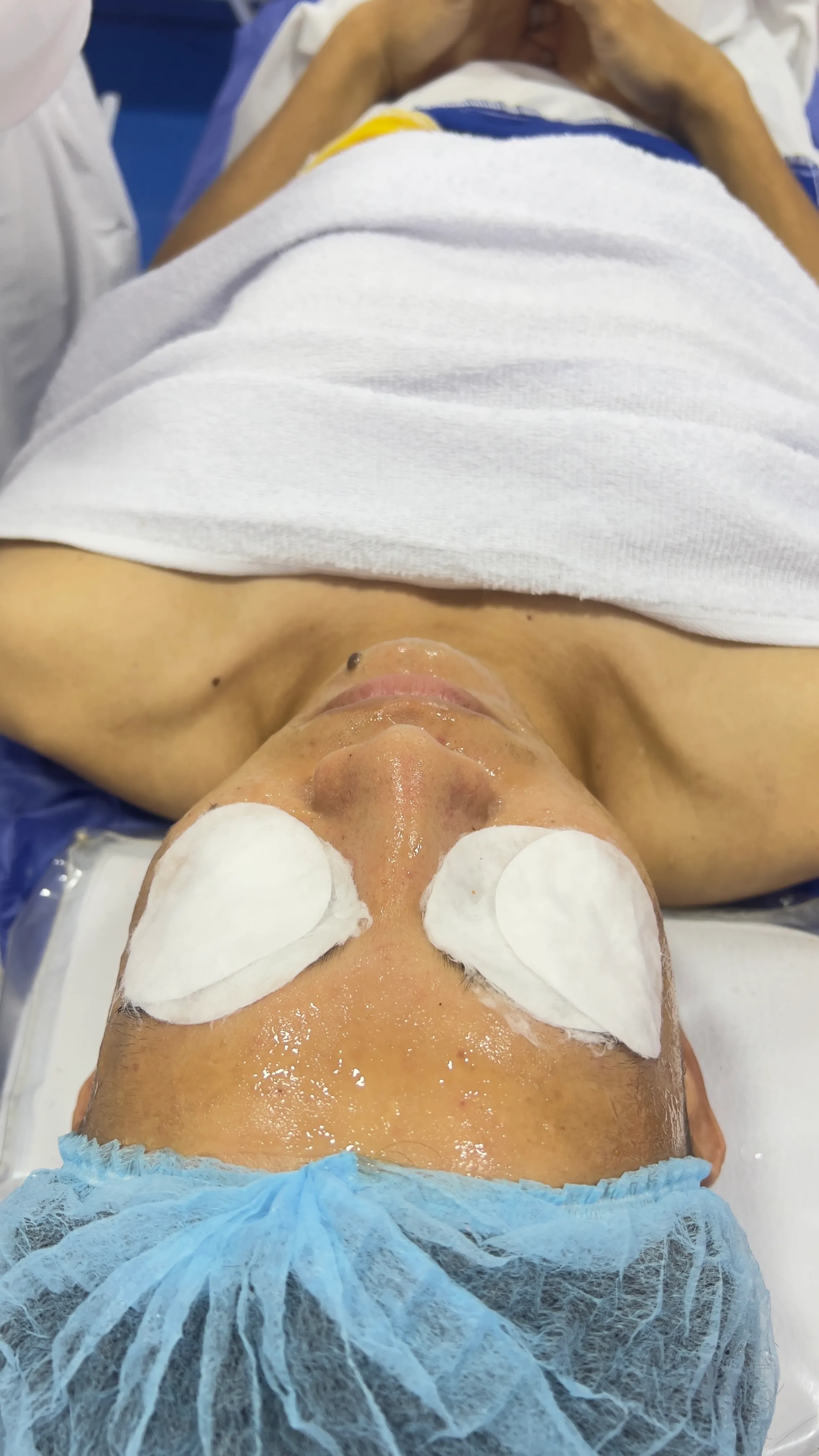 Limpieza Facial Profunda