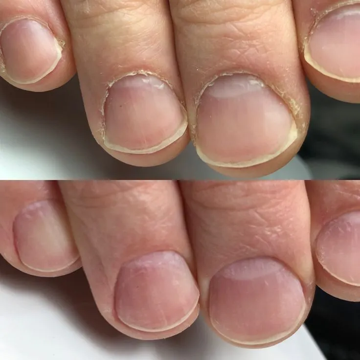 MANICURA CABALLERO
